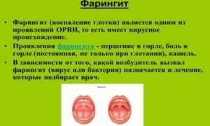 Вирусный Фарингит Симптомы И Лечение У Детей